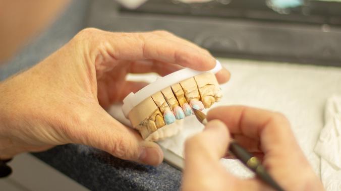 Российские ученые создали новые зубные импланты
