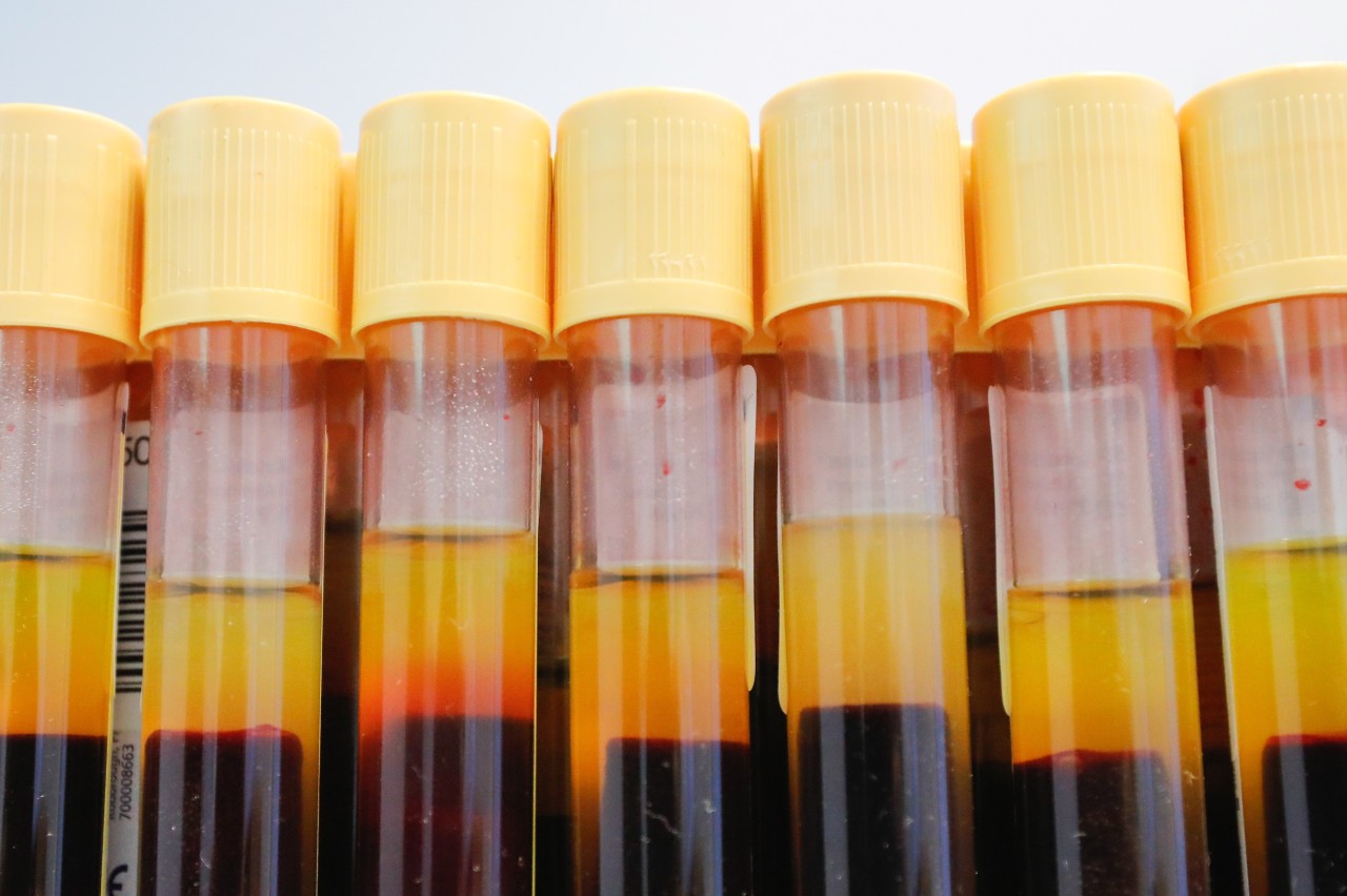 кровяной допинг. проба вада. наркоз полушарий. допинг тест. проба вада.