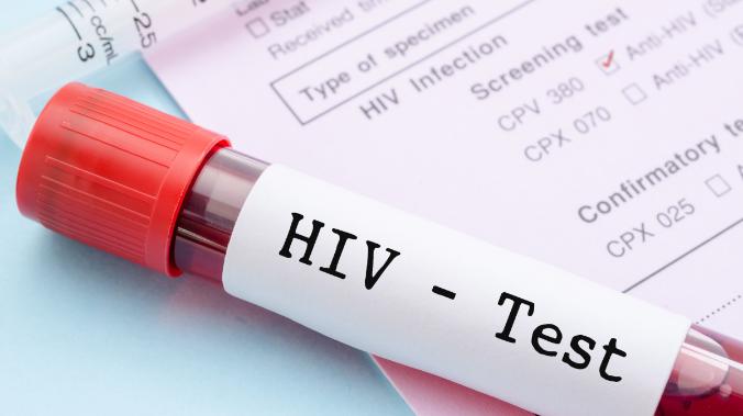 Минздрав опроверг вхождение РФ в топ-5 по заражению ВИЧ