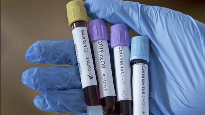 Коллективный иммунитет от коронавируса в России достиг 45 процентов