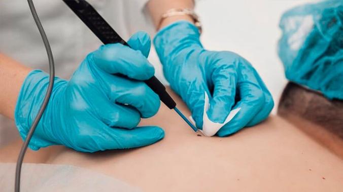 В России научились заживлять кожу без образования рубцов