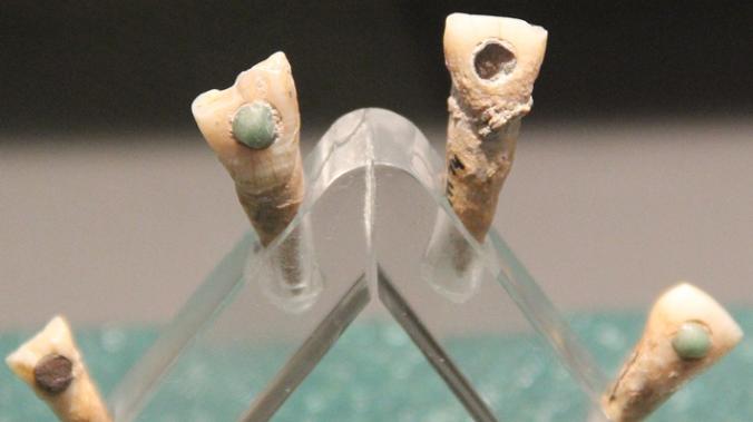 Древние майя пломбировали зубы драгоценными камнями