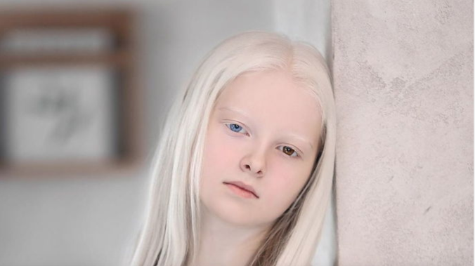 Школьница-альбинос из Чечни удивила интернет своей красотой