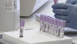 Крым получит более 22 млн руб. на борьбу с диабетом