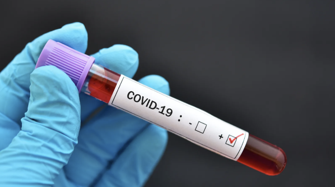 В США выявлено антитело способное нейтрализовать все известные штаммы SARS-CoV-2