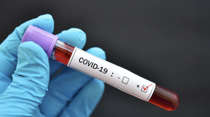 Ученые США не считают COVID-19 респираторным заболеванием